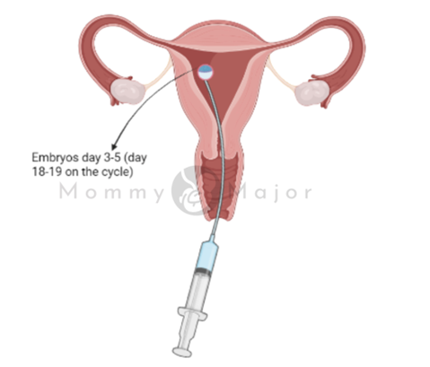 Graph IVF Uterus 2